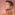 Relleno de mentón con ácido hialurónico - Hombre con un perfil facial atractivo y varonil gracias al relleno de mentón realizado en la mejor clínica estética Madrid