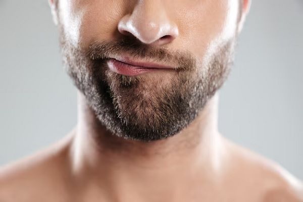 hombre mostrando sus labios antes del aumento de labios en hombres