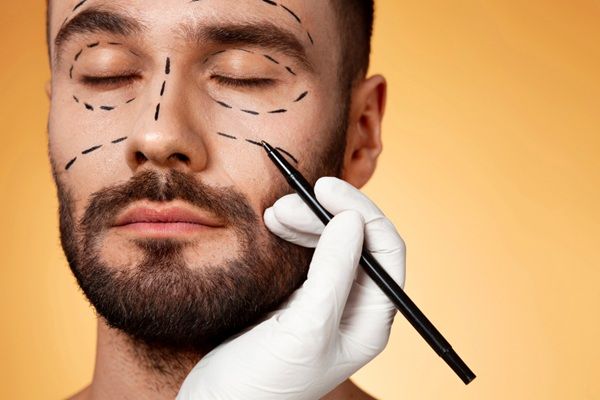 Precio bótox Madrid - Cirujano estético realizando el boceto del tratamiento bótox Madrid para caballeros en la mejor clínica estética Madrid