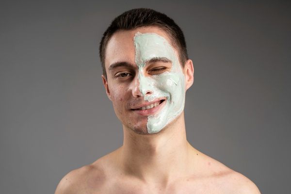 Peeling - Hombre joven con acné realizándose un tratamiento de peeling facial para renovar la piel