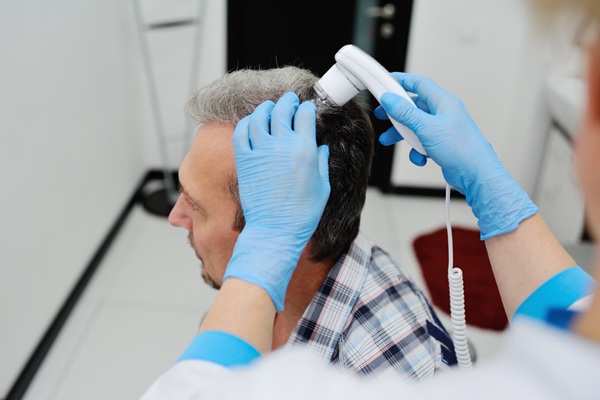 Mejor clínica injerto capilar Madrid - Médico capilar usando un tricoscopio para medir la densidad capilar de un hombre con alopecia antes de un trasplante capilar Madrid