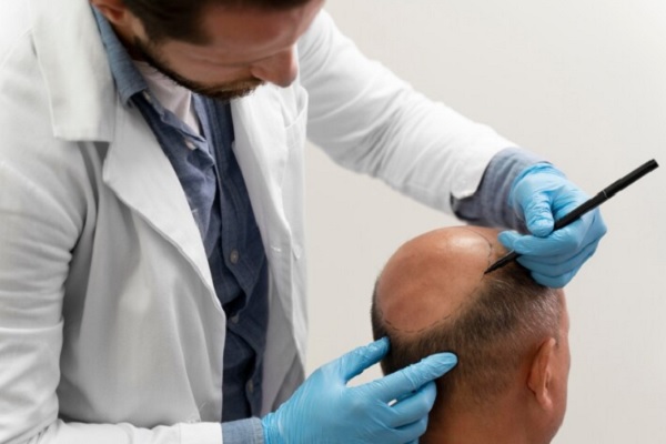 paciente siendo revisado por uno de los mejores doctores injerto capilar España